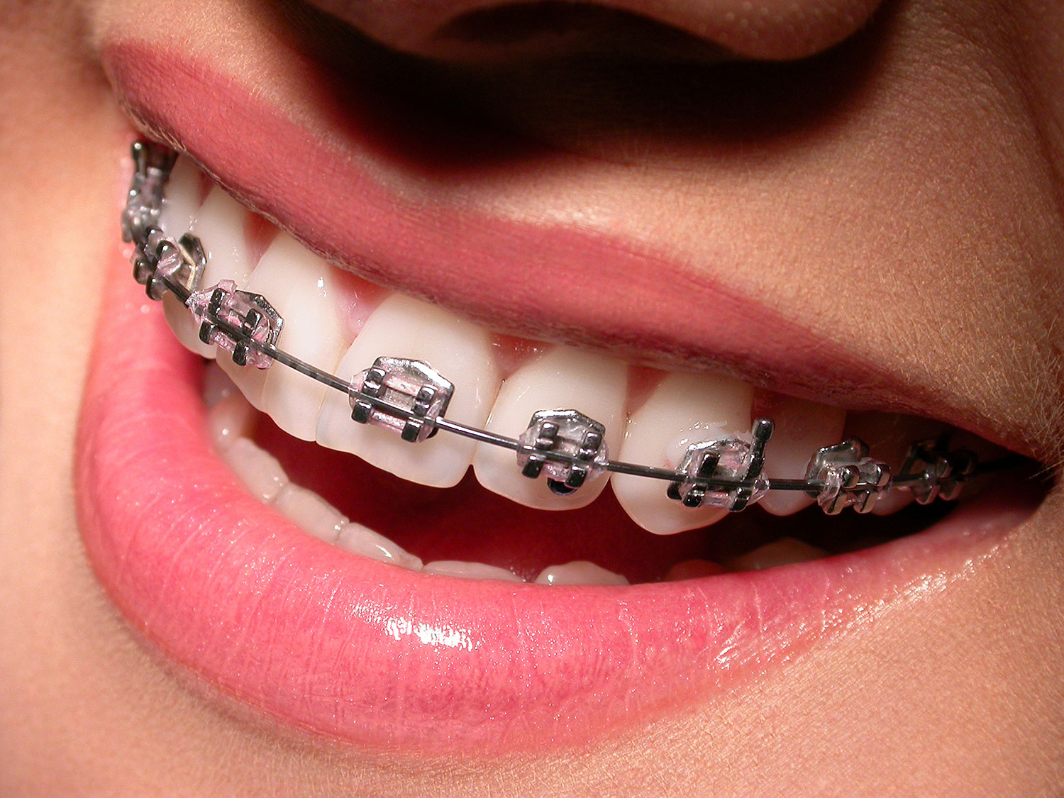 Orthodontics services